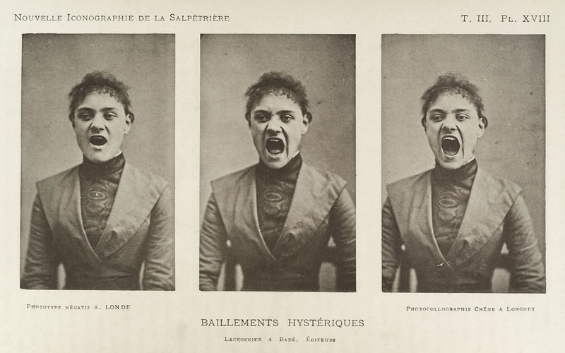 A hysterically yawning woman, Nouvelle iconographie de la Salpêtrière (1891)